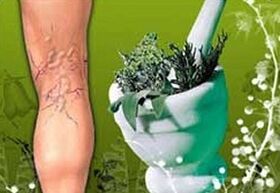 bylinky pro léčbu křečových žil