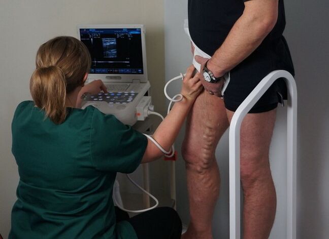 vyšetření žil před laserkoagulací na křečové žíly